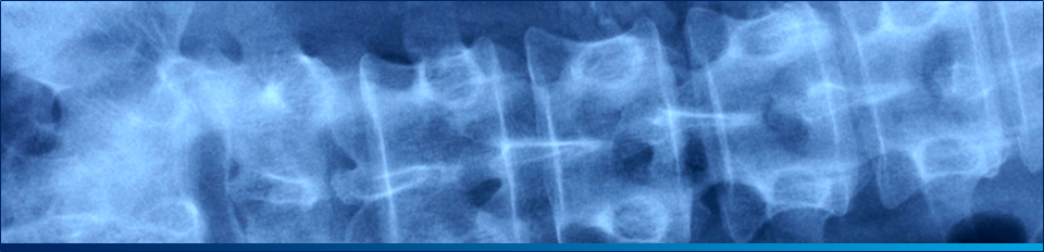 back injury xray at the clinic